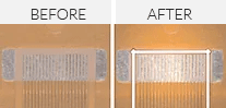 before and after quick laser